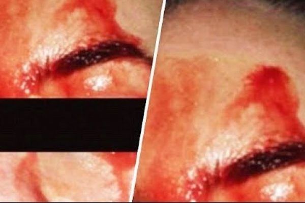 sweating blood